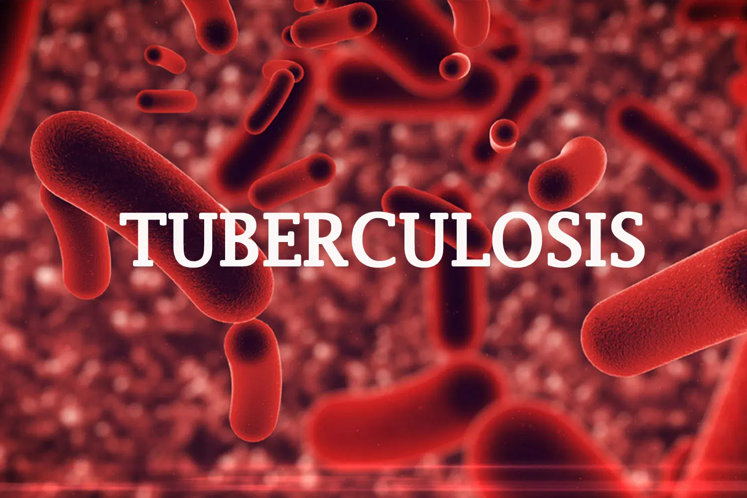 Over 50,000 Nigerians test positive for TB- Global Fund Over 50,000 Nigerians test positive for TB- Global Fund