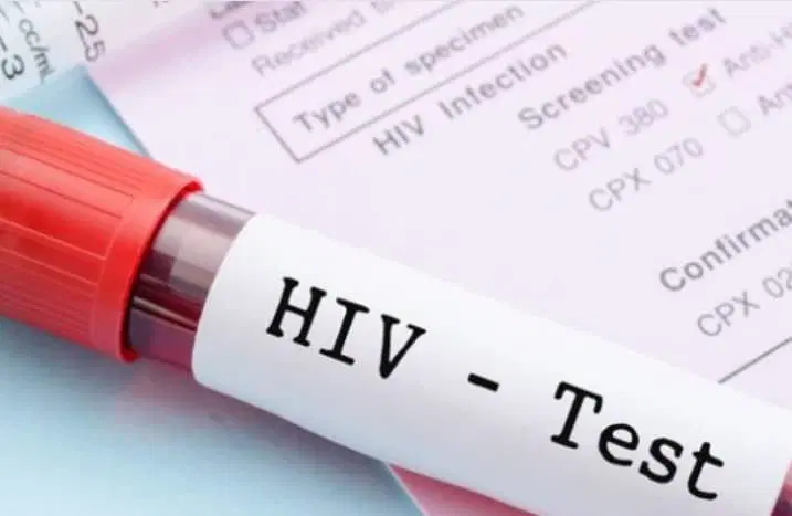 75% of new HIV infections among adolescents occur in girls – UNICEF 75% of new HIV infections among adolescents occur in girls – UNICEF