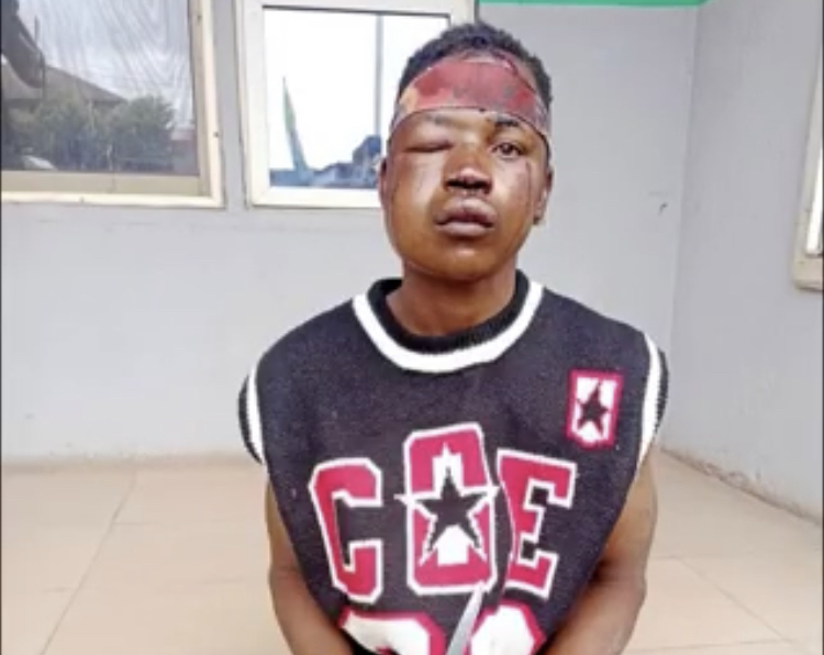 Police rescue man from jungle justice in Lagos Police rescue man from jungle justice in Lagos