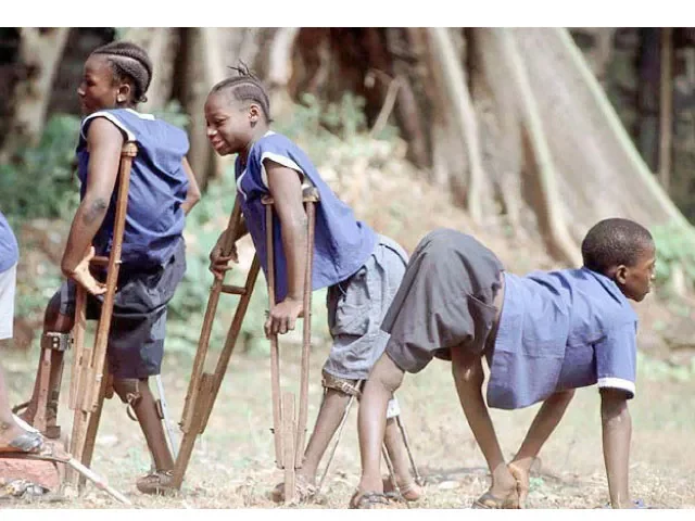 Polio cases drop by 44% nationwide — NEC Polio cases drop by 44% nationwide — NEC