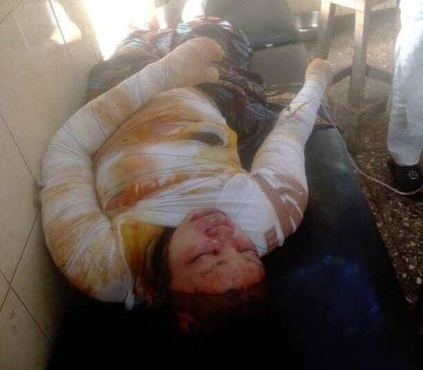Woman sets self ablaze in Bauchi